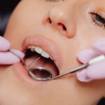 Zurich passa a oferecer assistencia odontologica emergencial no Vida Individual