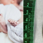 Confira o caso do bebe raro que nasceu com cauda