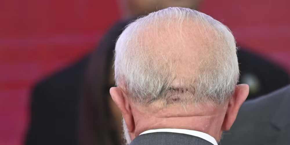 URGENTE Lula e operado as pressas em Sao Paulo apos.jpg