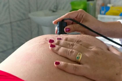 oms-300-mil-mulheres-morrem-anualmente-em-razao-de-gravidez-ou-parto-entidade-lanca-campanha-em-defesa-do-bem-estar-materno-e-neonatal-foto-arquivo-mds-tvt-news