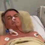 Apos cirurgia Bolsonaro fica em UTI sem previsao de alta.jpg