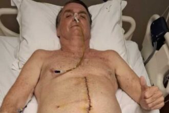Bolsonaro segue sem movimentos intestinais ha duas semanas e permanece.jpg
