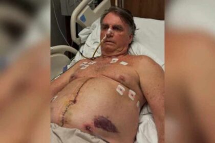 Na Pascoa Bolsonaro agradece apoio e atualiza estado de saude.jpg