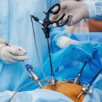 cirurgia-bariatrica-cfm-amplia-regras-e-inclui-adolescentes-cfm-reduz-o-imc-necessario-para-fazer-bariatrica-desde-que-a-pessoa-tenha-outras-doencas-imagem-sbcbm-tvt-news