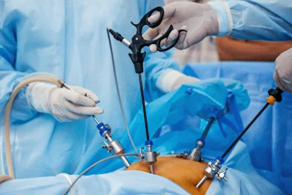 cirurgia-bariatrica-cfm-amplia-regras-e-inclui-adolescentes-cfm-reduz-o-imc-necessario-para-fazer-bariatrica-desde-que-a-pessoa-tenha-outras-doencas-imagem-sbcbm-tvt-news