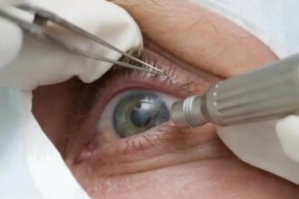 quais-os-riscos-da-cirurgia-que-altera-cor-dos-olhos-pacientes-relatam-dificuldade-de-enxergar-dor-nos-olhos-ardenciadentre-outros-efeitos-foto-pmtb-divulgacao-tvt-news