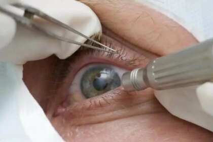 quais-os-riscos-da-cirurgia-que-altera-cor-dos-olhos-pacientes-relatam-dificuldade-de-enxergar-dor-nos-olhos-ardenciadentre-outros-efeitos-foto-pmtb-divulgacao-tvt-news