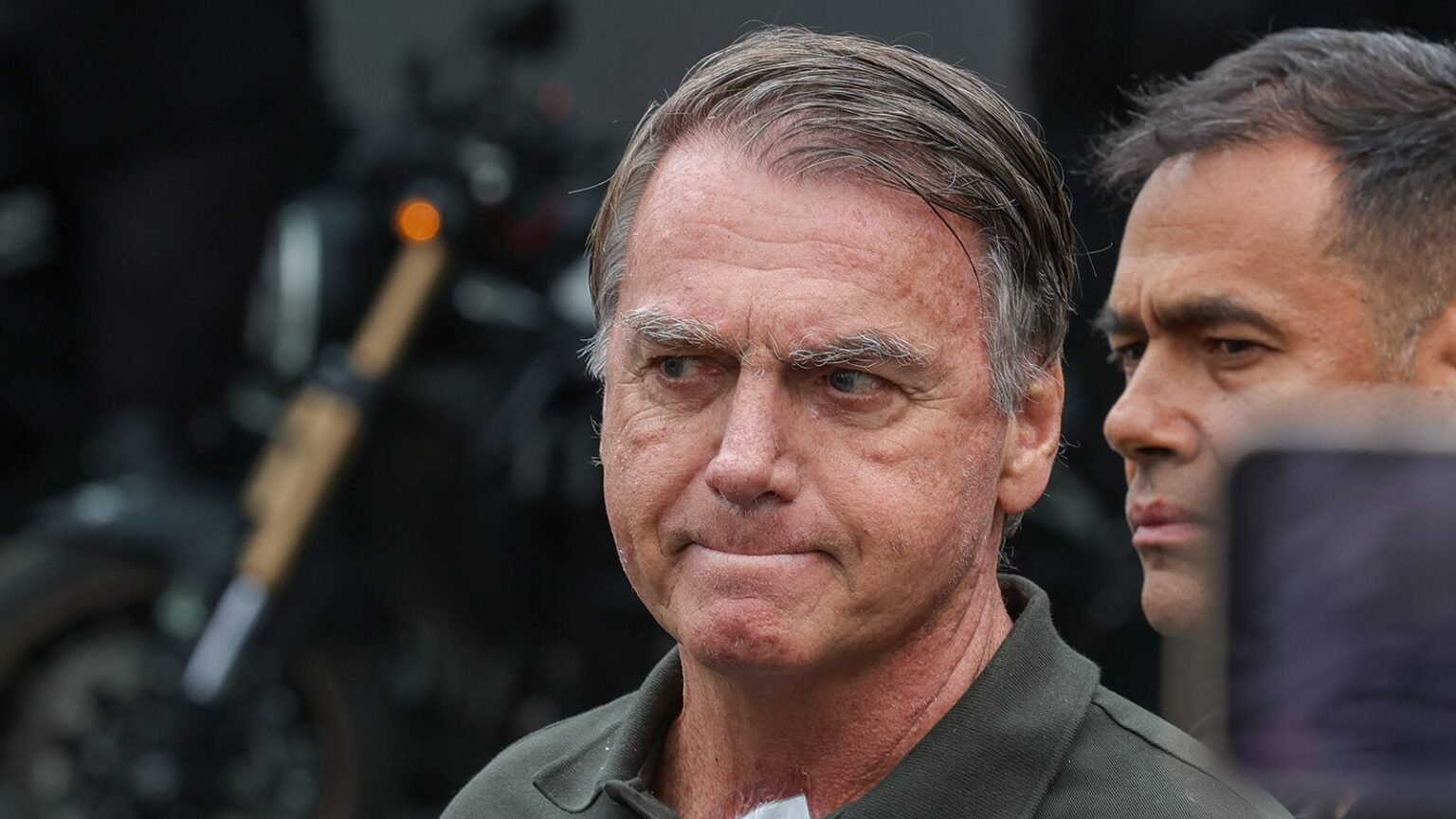 Bolsonaro tem funcao renal alterada e anemia.jpg