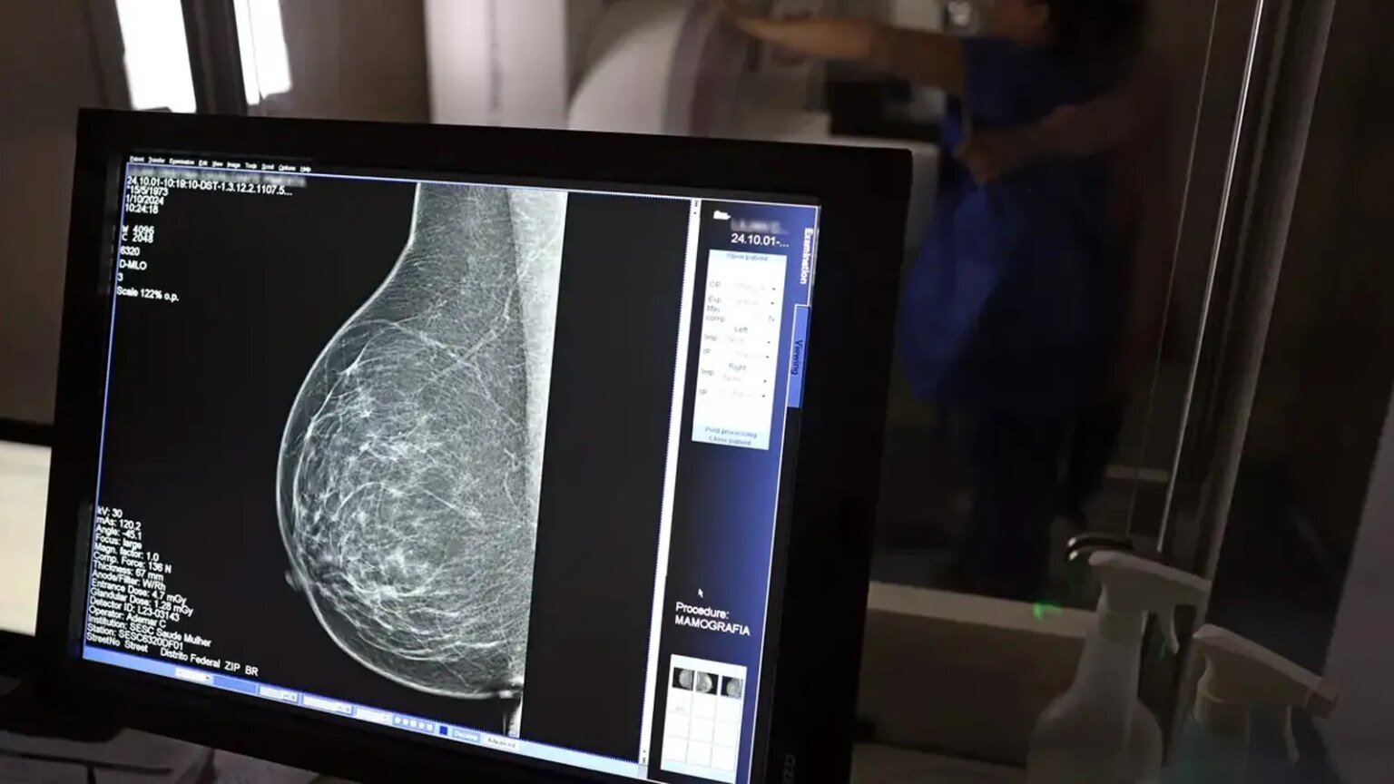 Ministério da Saúde passa a recomendar mamografia a partir dos 40 anos 1 ministerio-saude-recomendar-mamografia-partir-40-anos-jose-cruz-agencia-brasil-tvt-news