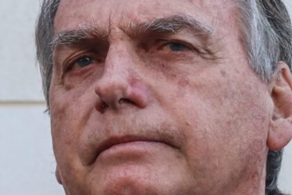 Moraes autoriza ida de Bolsonaro a hospital para procedimento na pele 12 moraes-autoriza-bolsonaro-ir-ao-hospital-tvt-news
