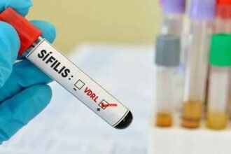 ministerio-da-saude-lanca-campanha-de-enfrentamento-a-sifilis-em-2025-a-oferta-do-teste-rapido-hiv-sifilis-aumentou-em-mais-de-40-foto-arquivo-abr-tvt-news