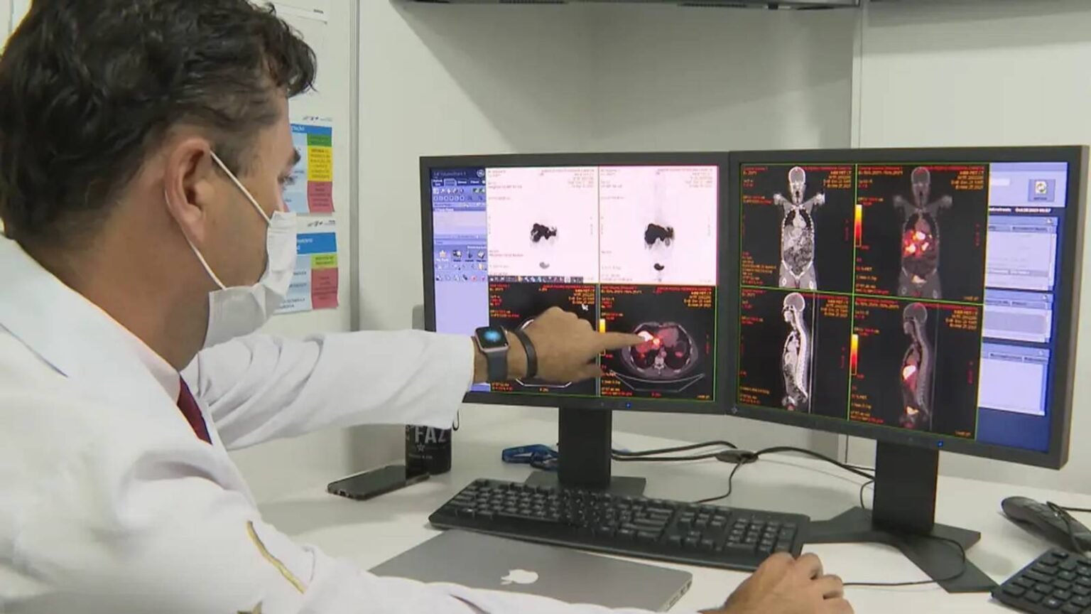 atendimento aumenta 32% em homens com até 49 anos 1 cancer-de-prostata-atendimento-aumenta-32-em-homens-com-ate-49-anos-homens-mais-jovens-tem-se-mostrado-mais-interessados-em-cuidar-da-saude-diz-especialista-foto-reproducao-tv-brasil-tvt-news