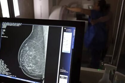 Lula sanciona lei que amplia acesso das mulheres a mamografia pelo SUS 12 lula-sanciona-lei-que-amplia-acesso-das-mulheres-a-mamografia-pelo-sus-deteccao-precoce-aumenta-as-chancas-de-cura-do-cancer-de-mama-foto-jose-cruz-agencia-brasil-tvt-news