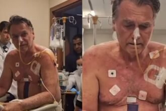 Medicos alertam para possivel estrangulamento intestinal em Bolsonaro.jpg