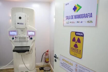 dia-da-mamografia:-sus-oferece-exame-exame-pode-ser-feito-sob-demanda-mesmo-sem-sintomas-foto-fabio-rodrigues-pozzebom-agencia-brasil-tvt-news